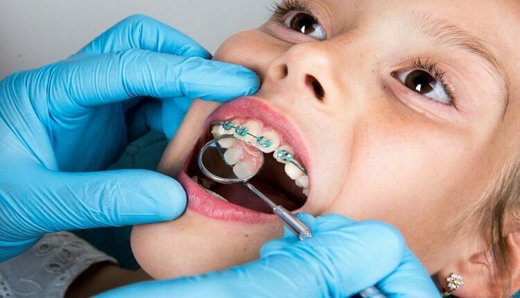 Orthodontic Treatment
